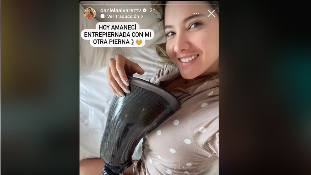 Daniela Álvarez compartió en sus historias de Instagram una foto donde aparece abrazando su prótesis.