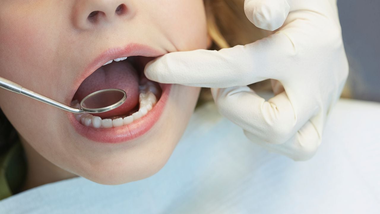 Odontología / Niños / Dientes