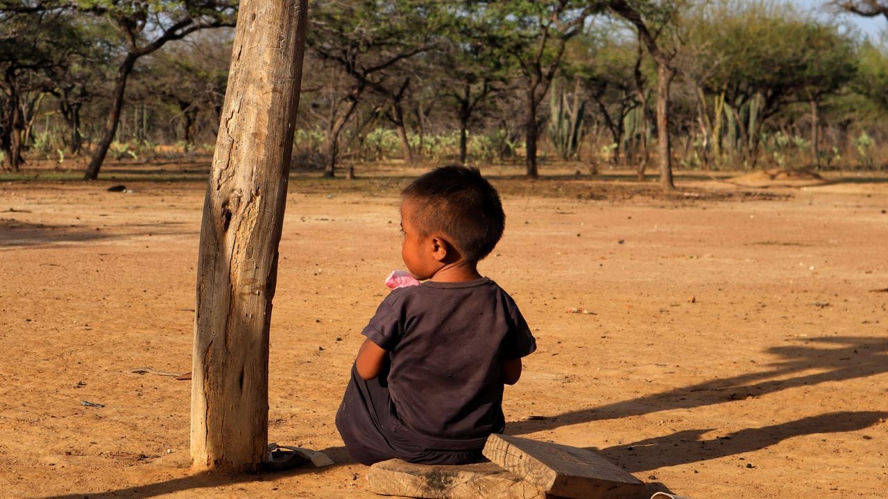 Niño wayúu con desnutrición crónica.