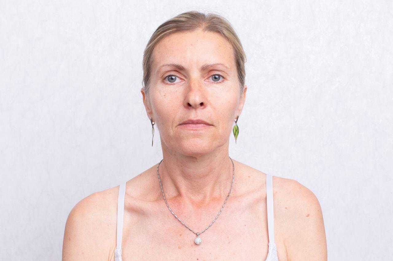 Face with signs of aging of an elderly woman. Aging skin.