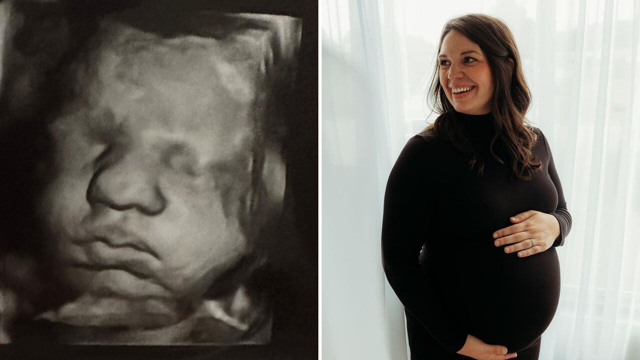 Kelsey Hatcher nació con dos úteros.