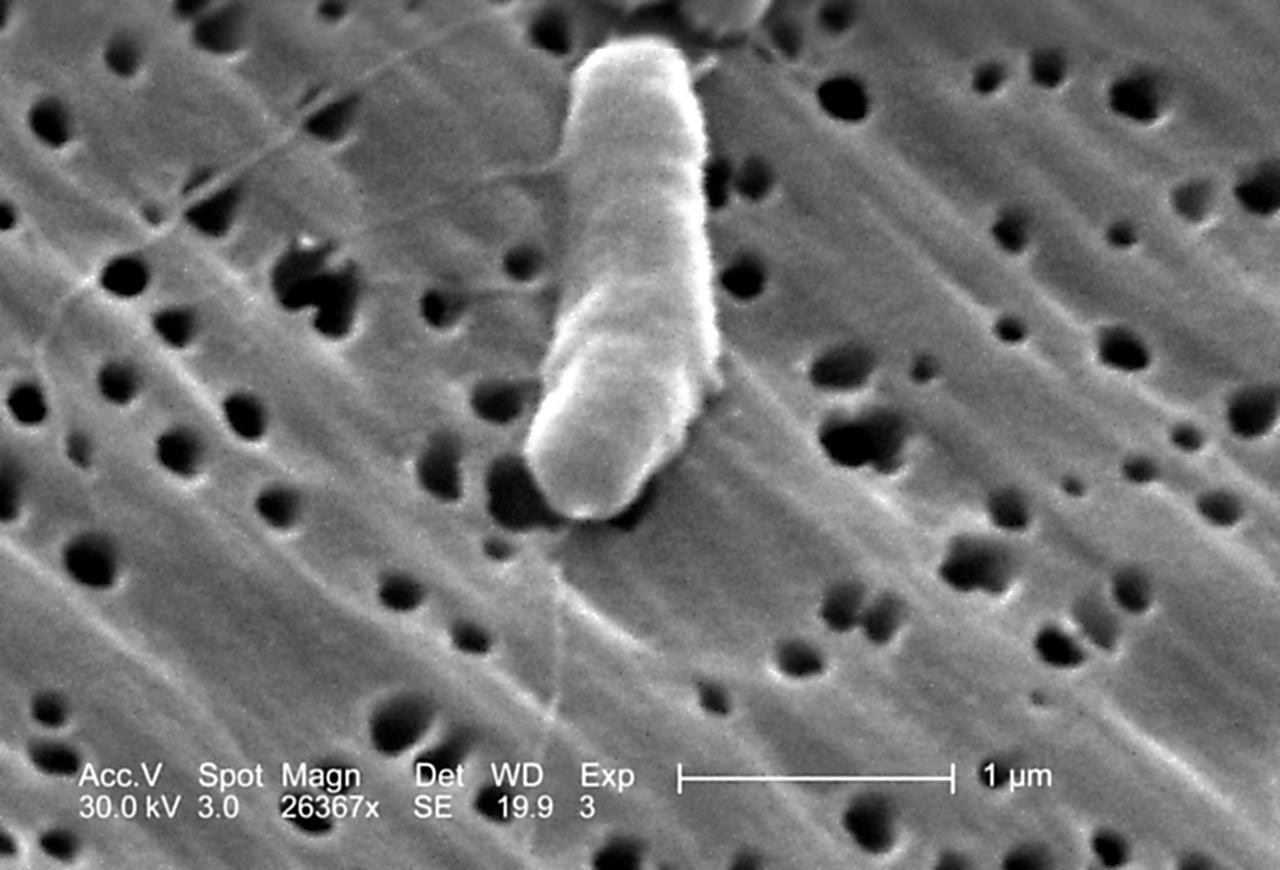 Bacteria Vibrio vulnificus flagelada revelada en la imagen del microscopio electrónico de barrido (SEM), 2005. Imagen cortesía de los Centros para el Control de Enfermedades (CDC)