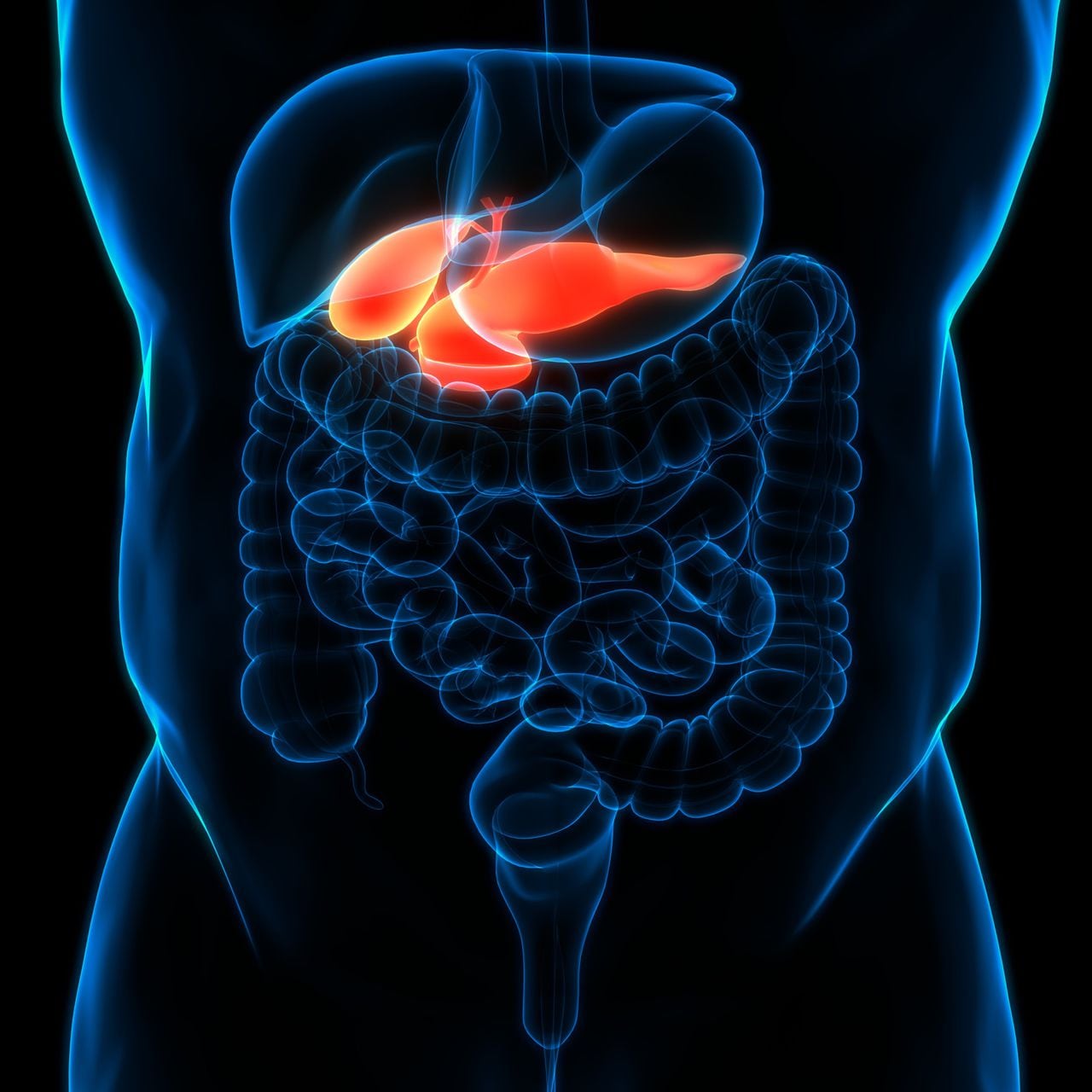 El cáncer de páncreas, uno de los más mortíferos a nivel mundial, rara vez se detecta en sus etapas iniciales, cuando es más curable.