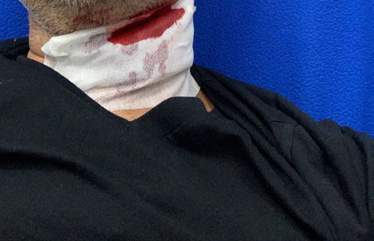 Una de las heridas que sufrió Mauricio Gutiérrez, por parte de un conductor de Uber en Medellín.