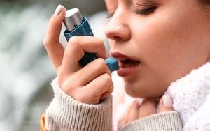 La rinosinusitis crónica con pólipos nasales tiene una relación directa con el asma y la dermatitis atópica, pues en ambas el paciente presenta inflamación tipo 2.