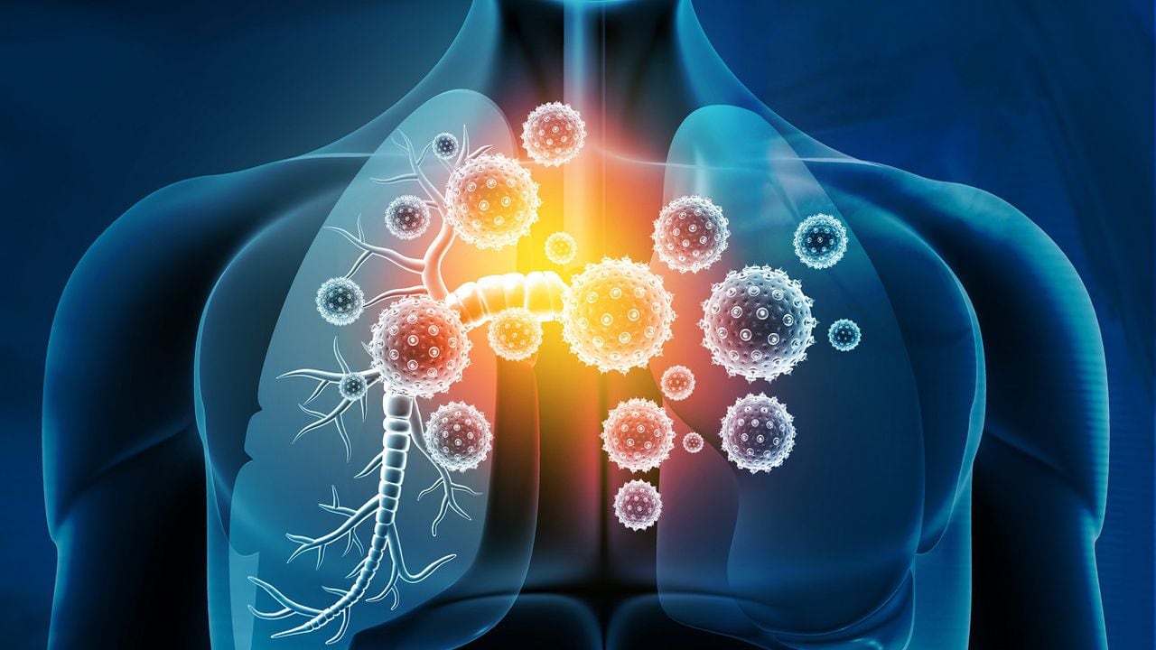 infecciones en bronquios y pulmones