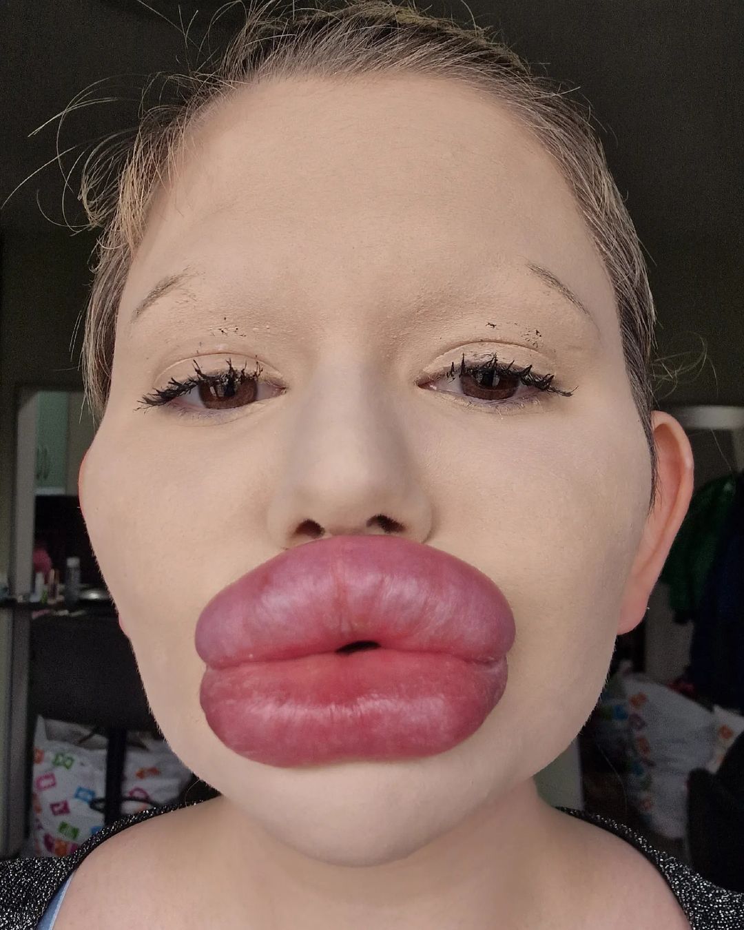 La mujer ha ganado gran reconocimiento gracias al aumento de labios que la han llevado a ganar el récord como la personas con los labios más grandes del mundo.