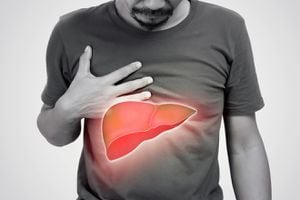 El hígado graso es una afección que puede derivar en complicaciones de salud.
