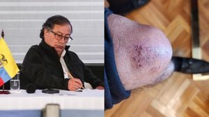 El mandatario sigue en medio de la polémica por la foto que subió a Twitter con su rodilla herida.