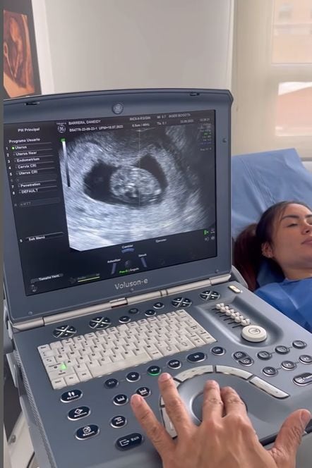 Epa Colombia confirmó su embarazo con emotivo video junto a su novia