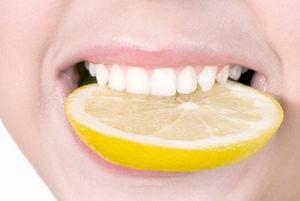 El limón, aunque saludable, puede causar erosión del esmalte dental debido a su alta acidez.