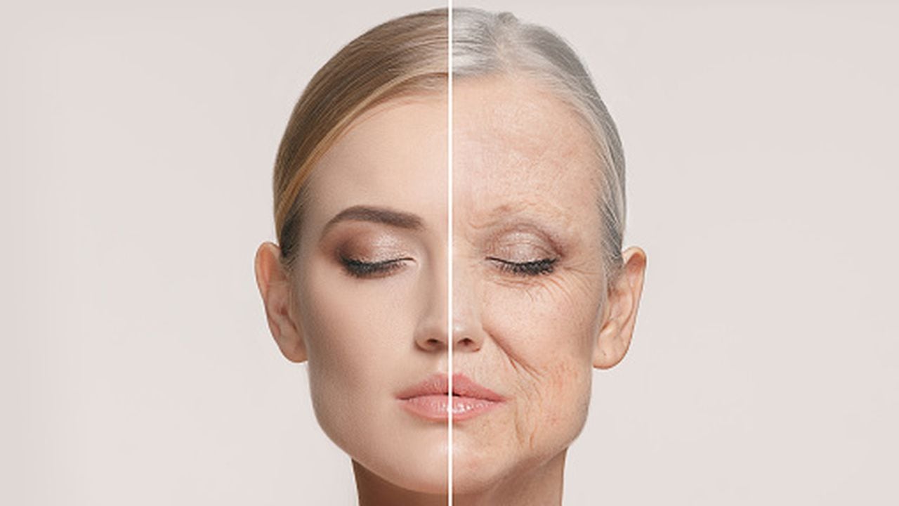 Las arrugas son parte del envejecimiento natural de la piel.