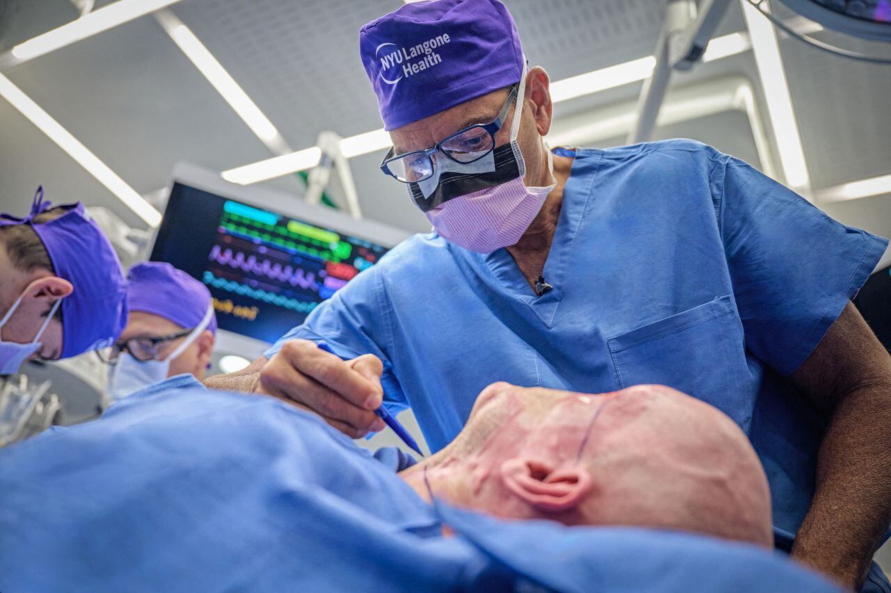 Imagen publicada por NYU Langone Health, el Dr. Eduardo Rodríguez opera a Aaron James en el primer trasplante de rostro completo y parcial, en NYU Langone Health en Nueva York.