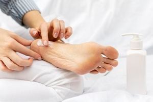 La falta de hidratación en los pies puede ocasionar complicaciones de salud.