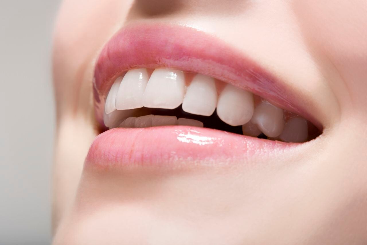 Foto de referencia sobre dentadura