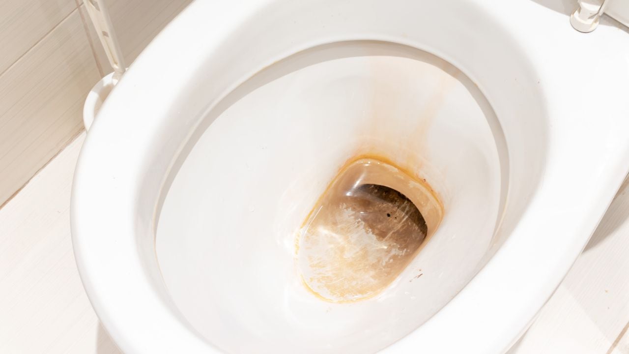 Las manchas amarillas en un inodoro se pueden presentar por diferentes motivos, pero dejan el reflejo de poca higiene.