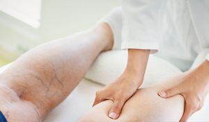 Consumir nueces, semillas, cacao y chocolate negro ayuda a mejorar la circulación