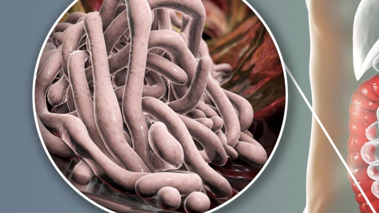 Los parásitos intestinales son un problema de salud común que puede tratarse de manera natural.