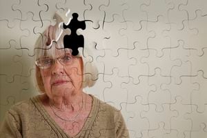 Alzheimer, pérdida de memoria y demencia senil.