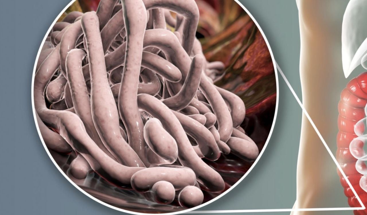Los parásitos intestinales son un problema de salud común que puede tratarse de manera natural.