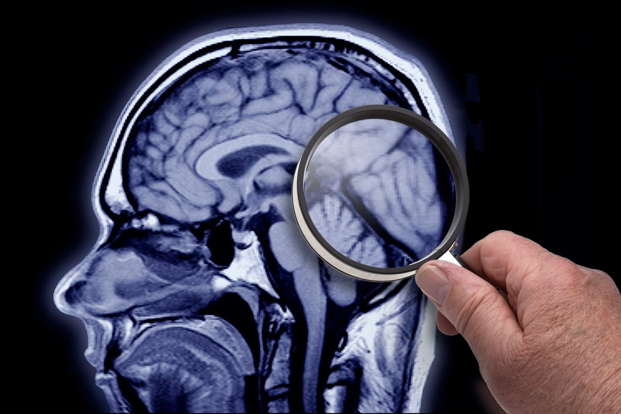La salud cerebral es indispensable para el organismo, por lo que una buena alimentación puede ayudar a prevenir afectaciones.