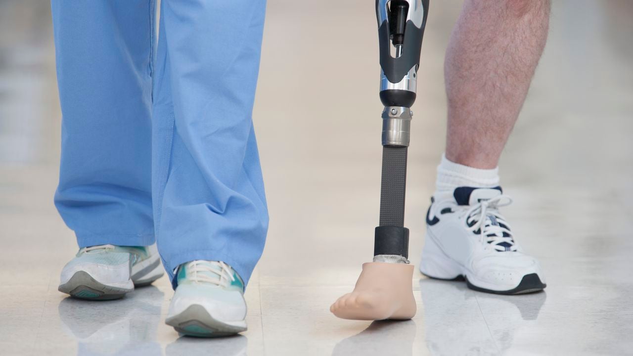 Debido a los altos costos, solo uno de cada 10 personas en el mundo que necesitan una prótesis, tiene acceso a ella.