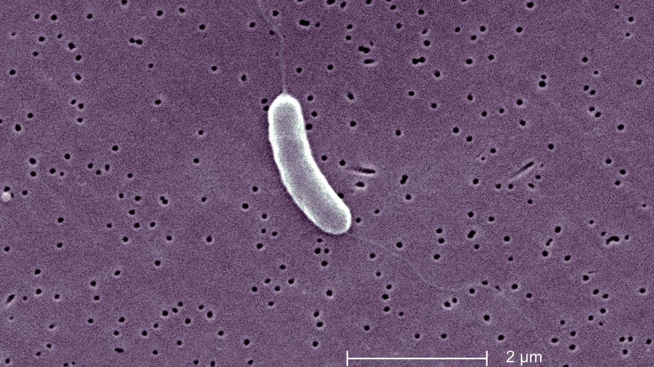 Esta micrografía electrónica de barrido Sem representa una bacteria Vibrio Vulnificus flagelada; revista 13184X. Vibrio Vulnificus es una bacteria de la misma familia que las que causan el cólera. Normalmente vive en agua de mar tibia y es parte de un grupo de vibriones que se llaman "halofílicos" porque requieren sal.