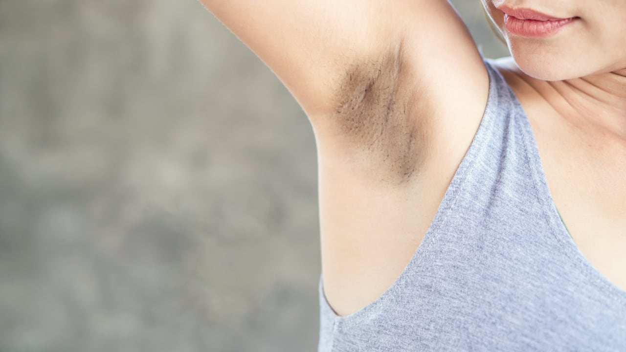 Las axilas se pueden manchar por cambios hormonales.