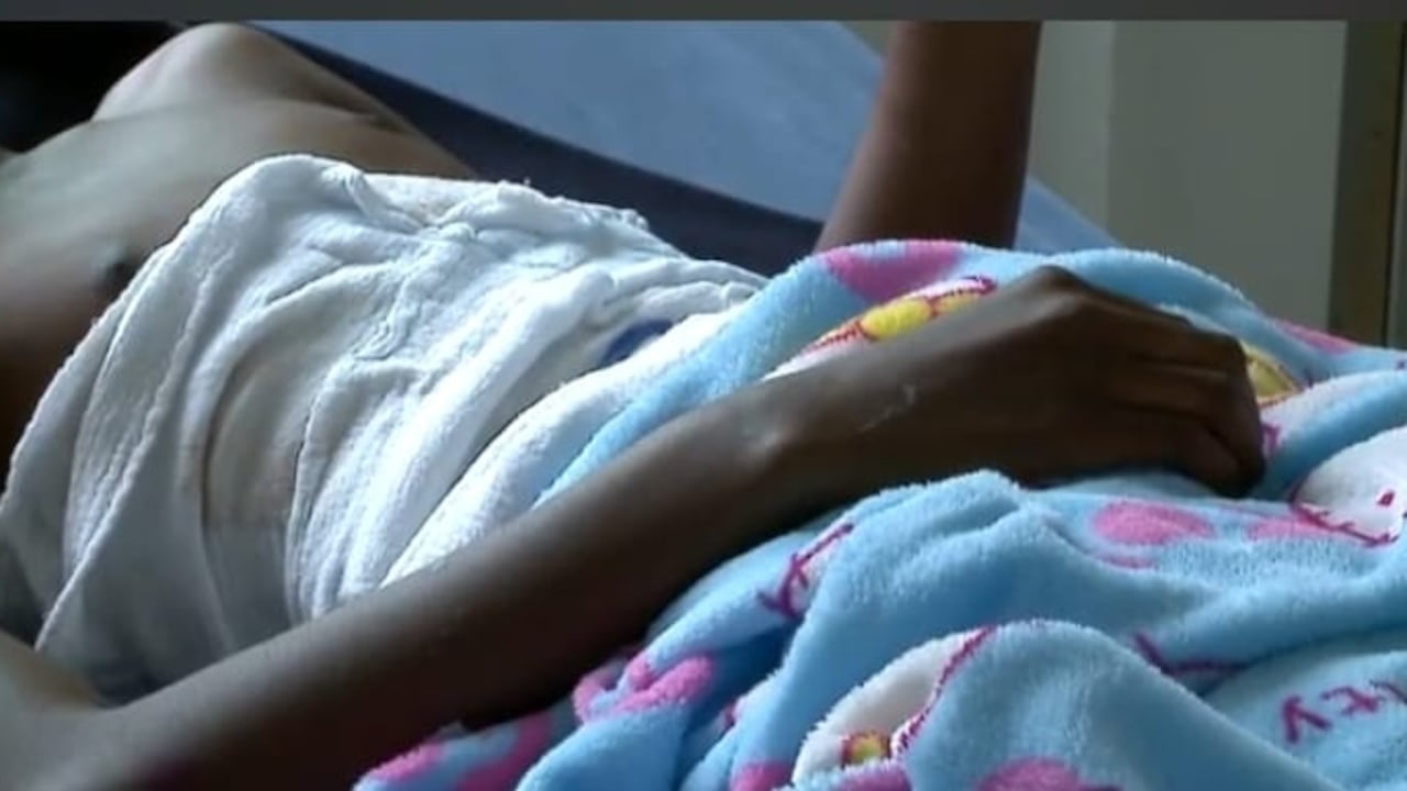 Afectados por pólvora