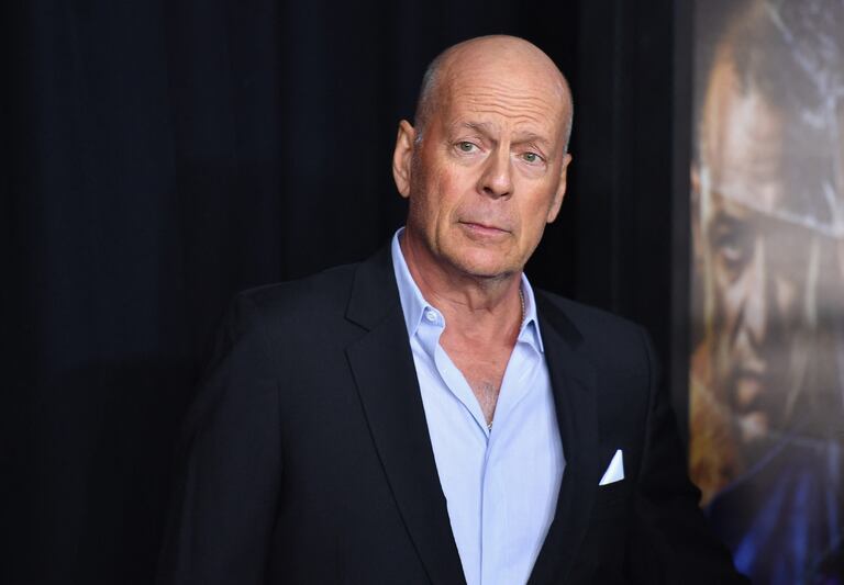 El actor Bruce Willis fue diagnosticado con demencia fotofrontal.