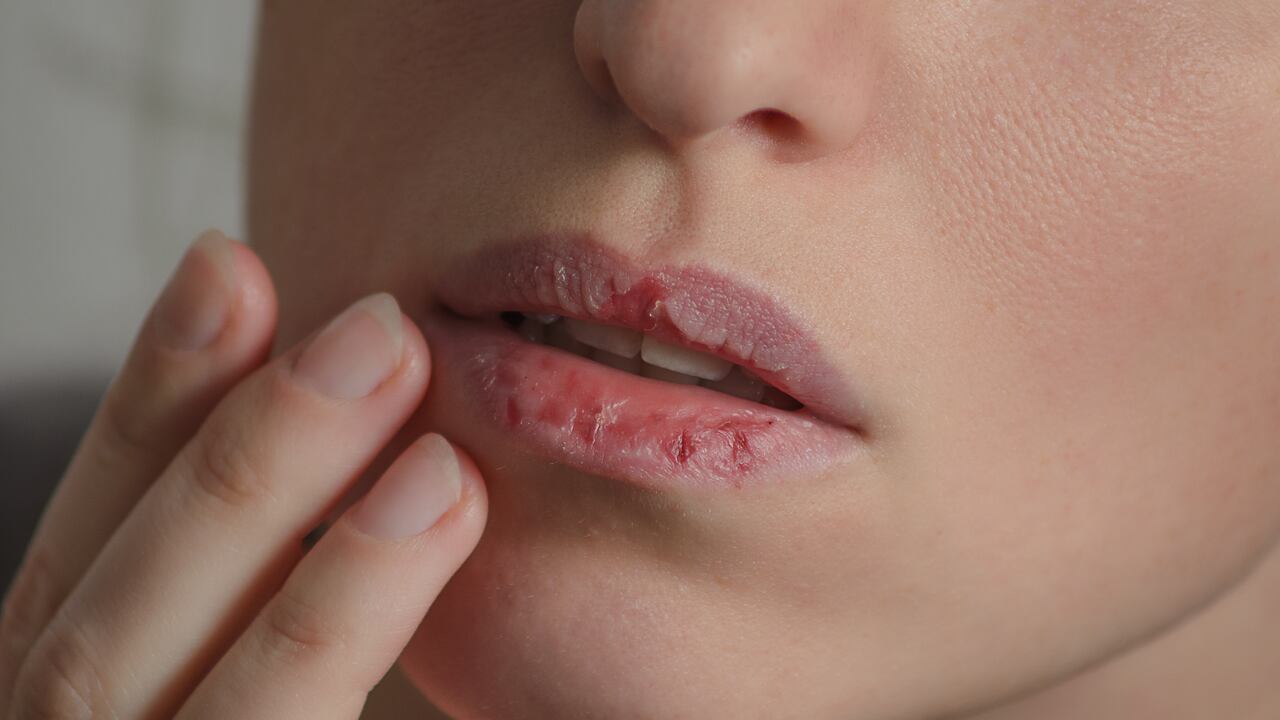 Enfermedad de la boca