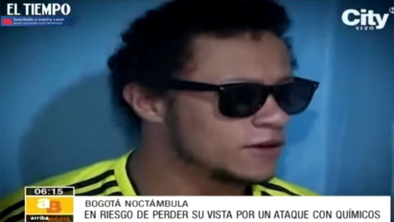 Actor de ‘Sin senos no hay paraíso’ que sufrió ataque con ácido, ahora pide dinero en los buses: “nadie me emplea”