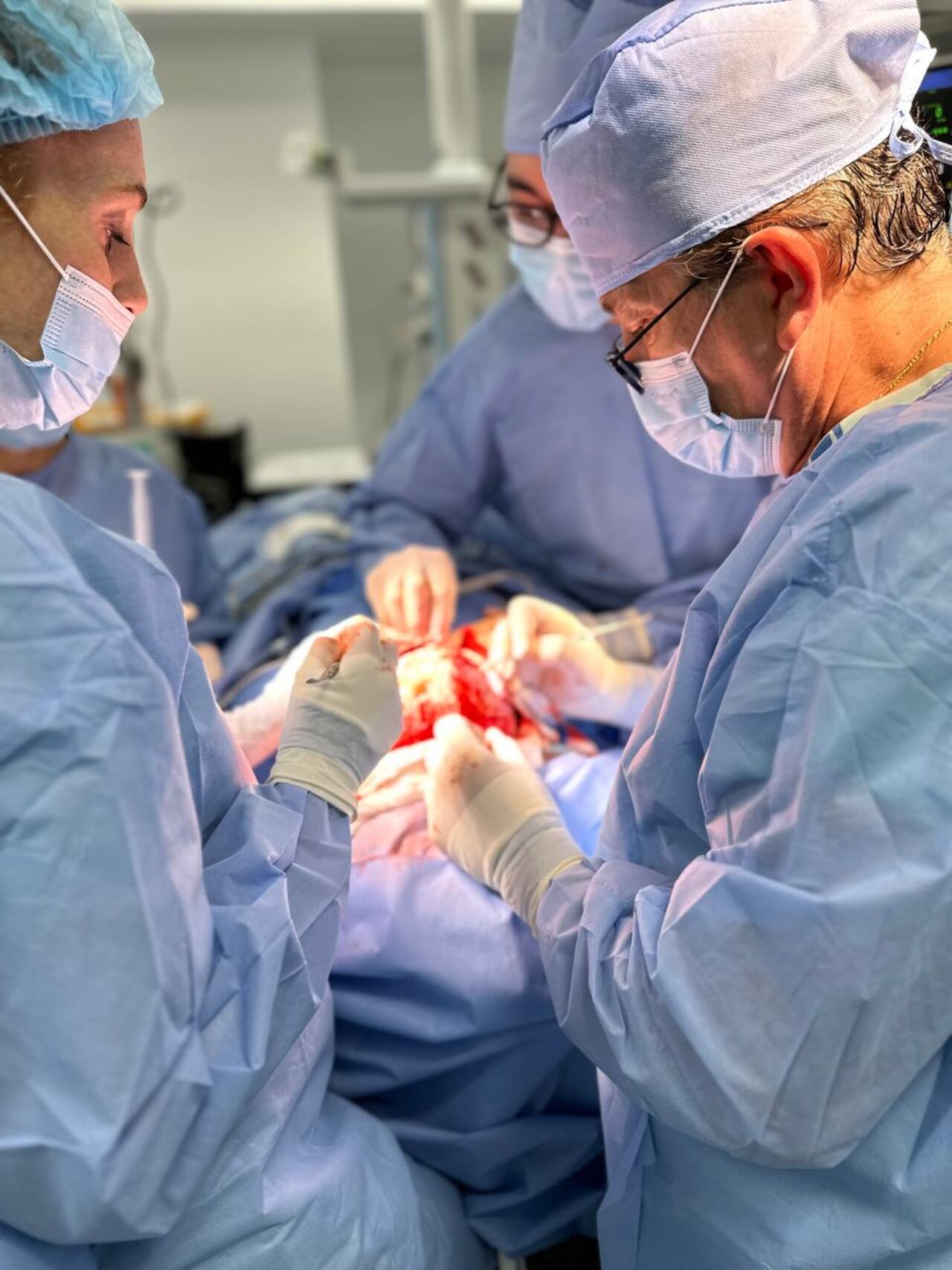 El caso de Martín fue evaluado por una junta médica multidisciplinaria de craneosinostosis de la Fundación Clínica Infantil Club Noel.