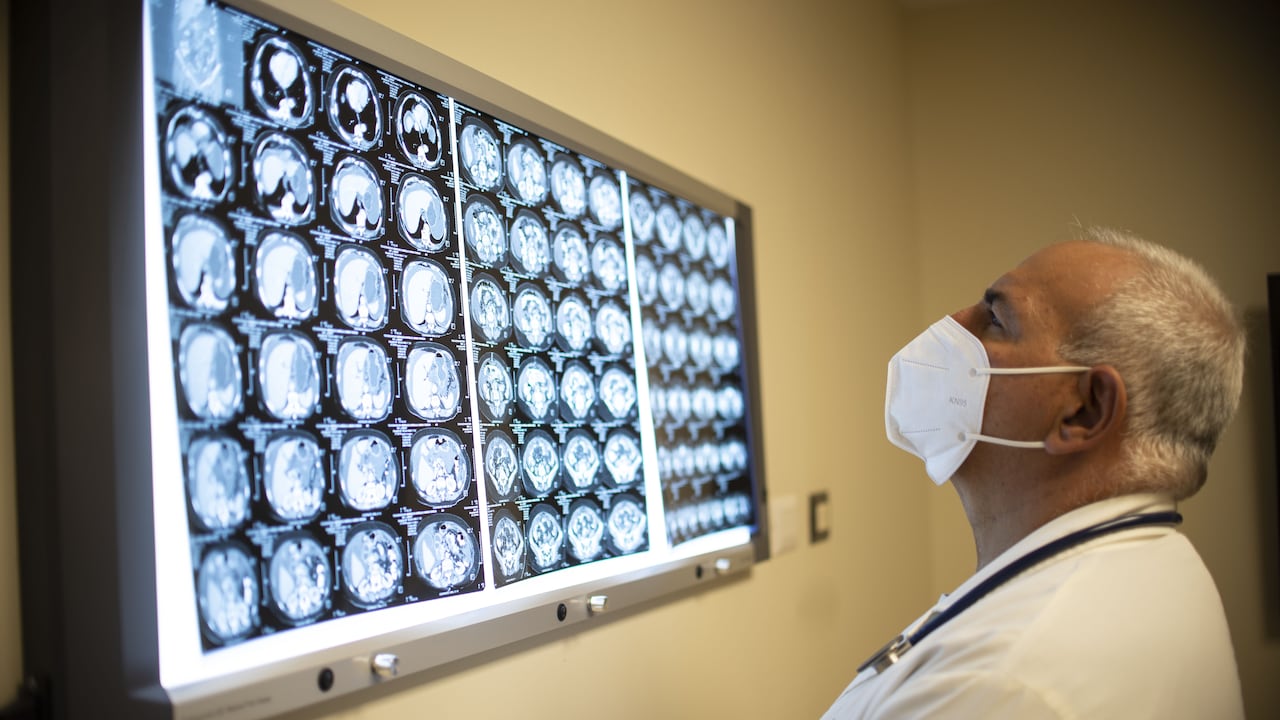 La ciencia ha tratado de encontrar un tratamiento 100% efectivo contra el cáncer