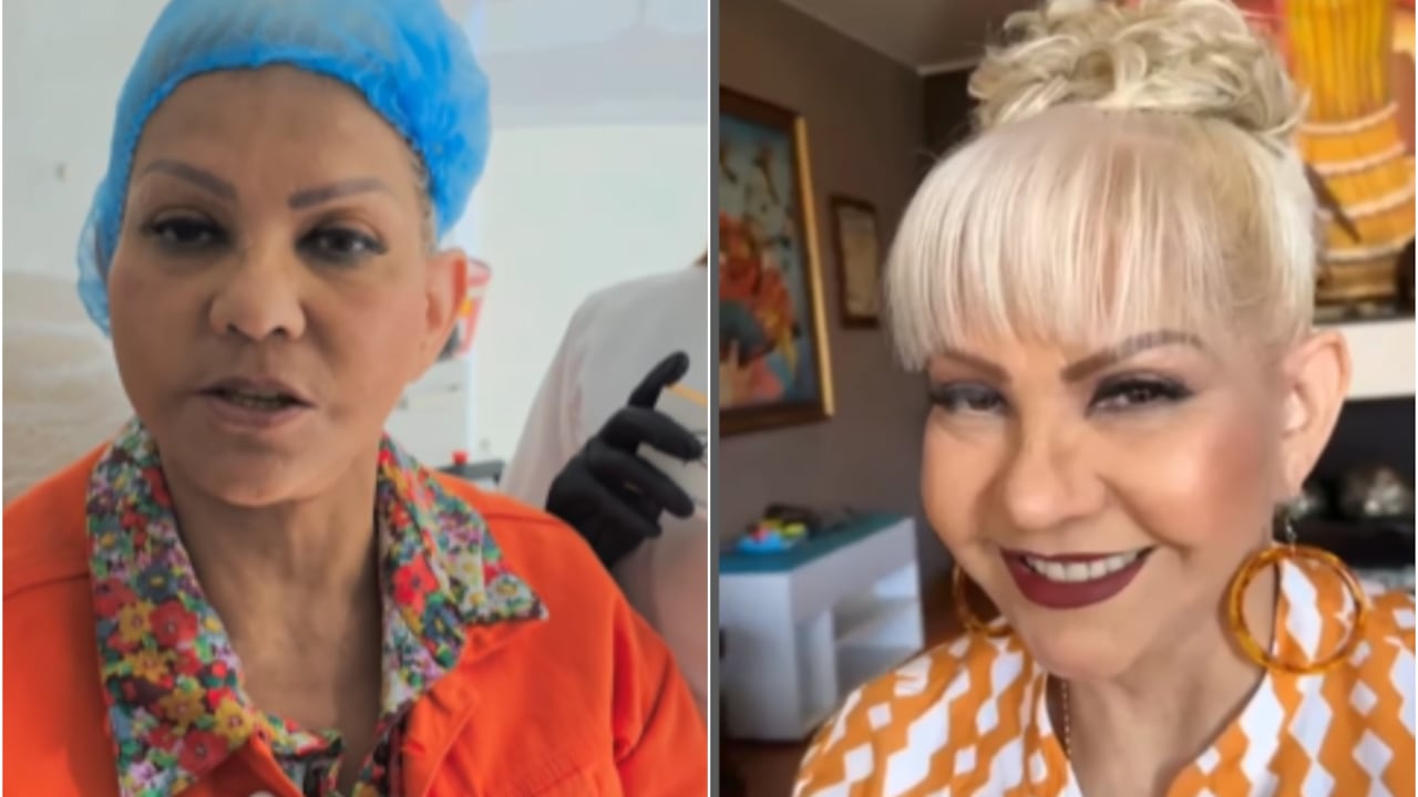 La Gorda Fabiola se sometió nuevamente a un tratamiento estético y fue duramente criticada.