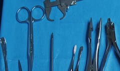 Mujer fue intervenida por tener tijeras en su abdomen.