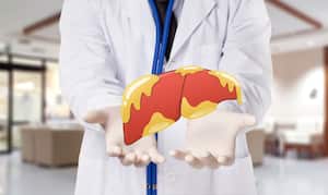 El hígado graso se puede presentar por la ingesta de una alimentación inadecuada.