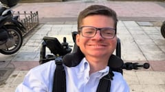 Andrés es uno de los cerca de 100 casos en el mundo diagnosticados con amiopatía congénita.