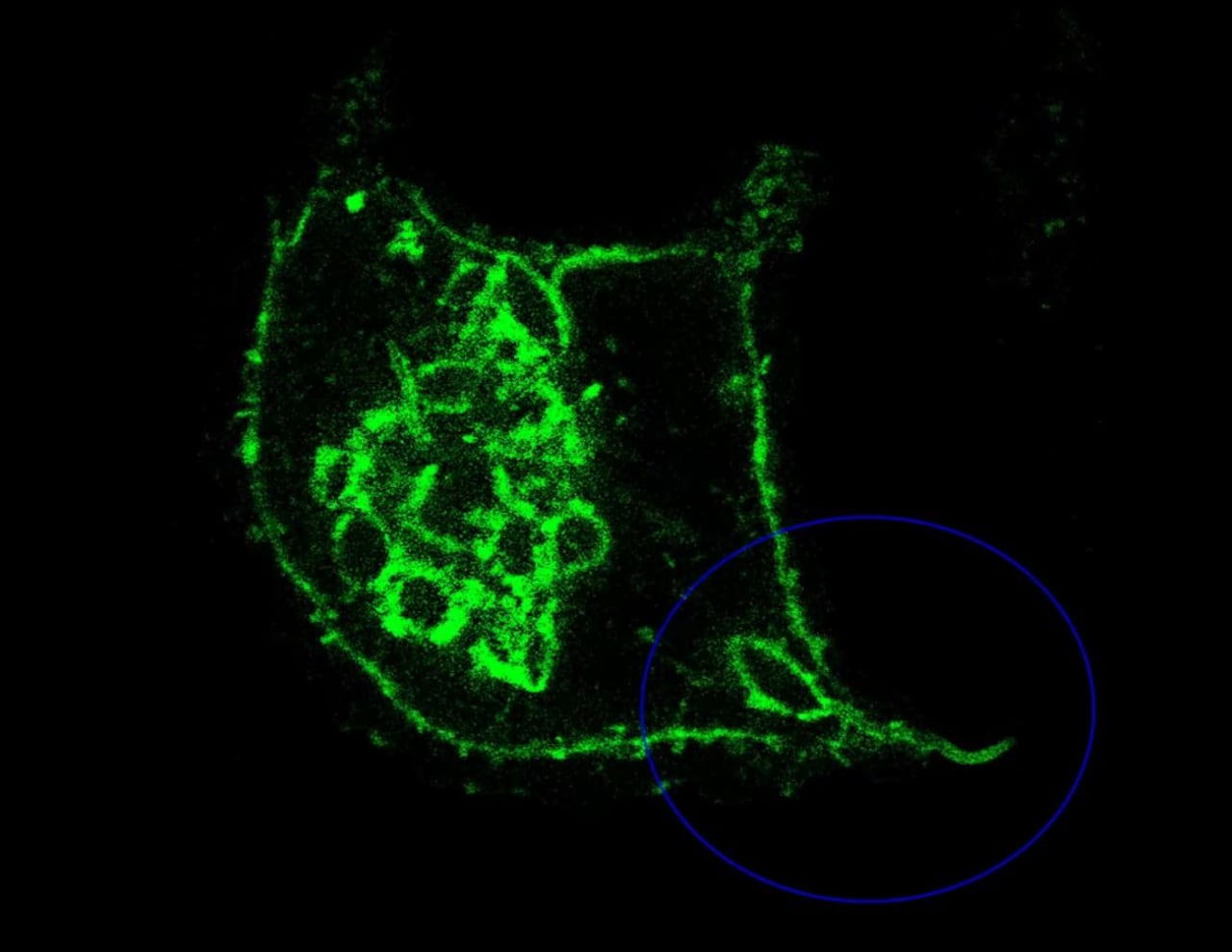 Una célula de macrófago humana "devorando" un parásito de leishmania, en el círculo amarillo.