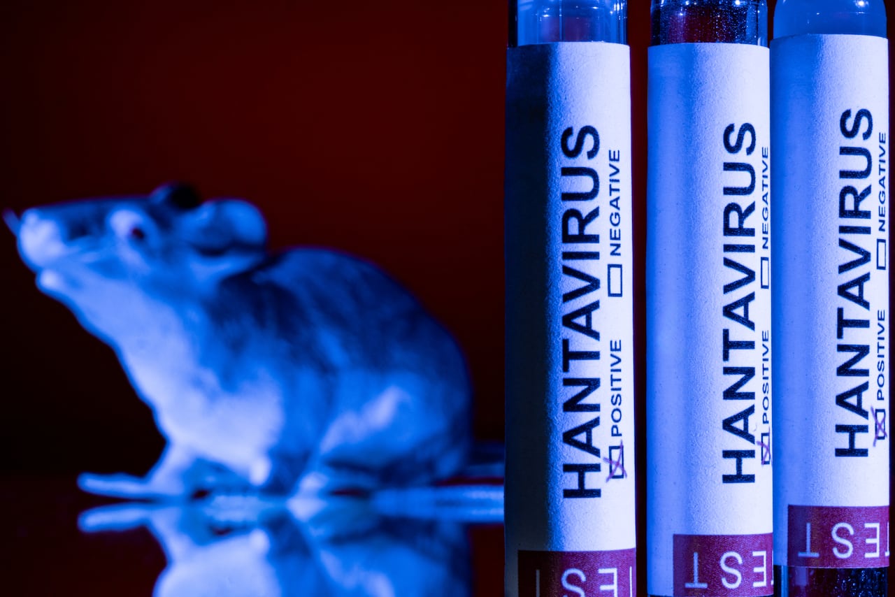 This photo taken in Paris on May 11, 2026 shows vials bearing the name of "hantivirus". A deadly hantavirus outbreak on a cruise ship has spurred global concern over the potential spread of the virus among and from ship evacuees as they head back to their home countries. Here are the World Health Organization's main recommendations to limit the transmission risks and to better protect those exposed to the rare virus, which usually spreads among rodents, and for which there is no vaccine or treatment. (Photo by Joel Saget / AFP)