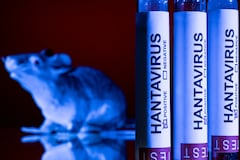 This photo taken in Paris on May 11, 2026 shows vials bearing the name of "hantivirus". A deadly hantavirus outbreak on a cruise ship has spurred global concern over the potential spread of the virus among and from ship evacuees as they head back to their home countries. Here are the World Health Organization's main recommendations to limit the transmission risks and to better protect those exposed to the rare virus, which usually spreads among rodents, and for which there is no vaccine or treatment. (Photo by Joel Saget / AFP)