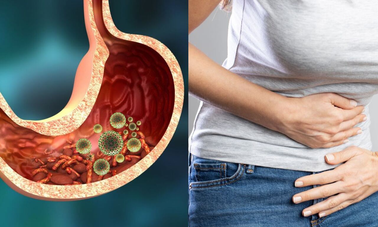 Parásitos intestinales e hinchazón abdominal.