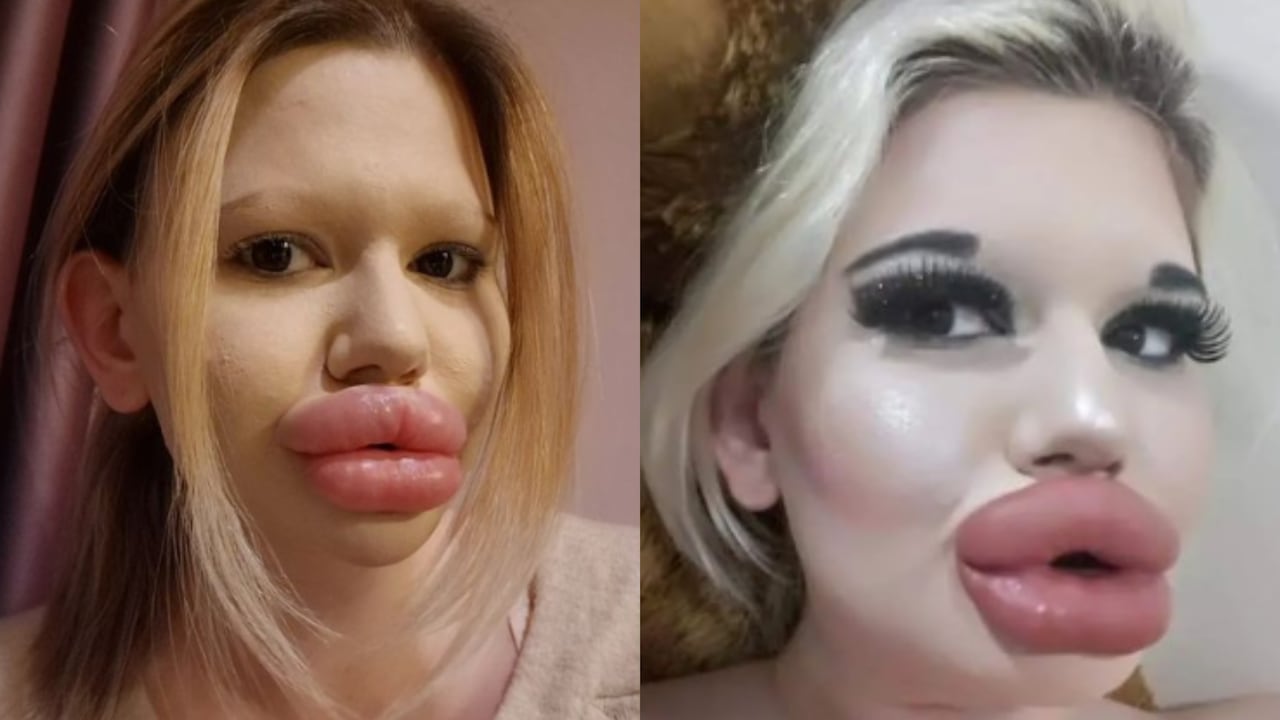 Andrea Ivanova, la mujer con los labios más grandes del mundo.