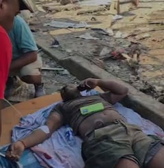 Esta situación se conoció gracias a un vídeo donde se aprecia como los dos policías son atendidos por los pobladores, quienes piden ayuda para ser trasladados a un hospital.