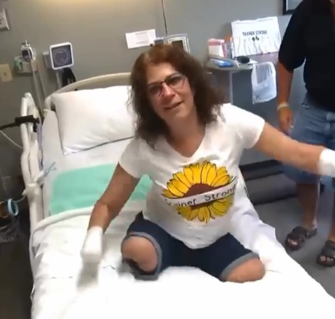 La infección que dejó a una mujer sin brazos ni piernas