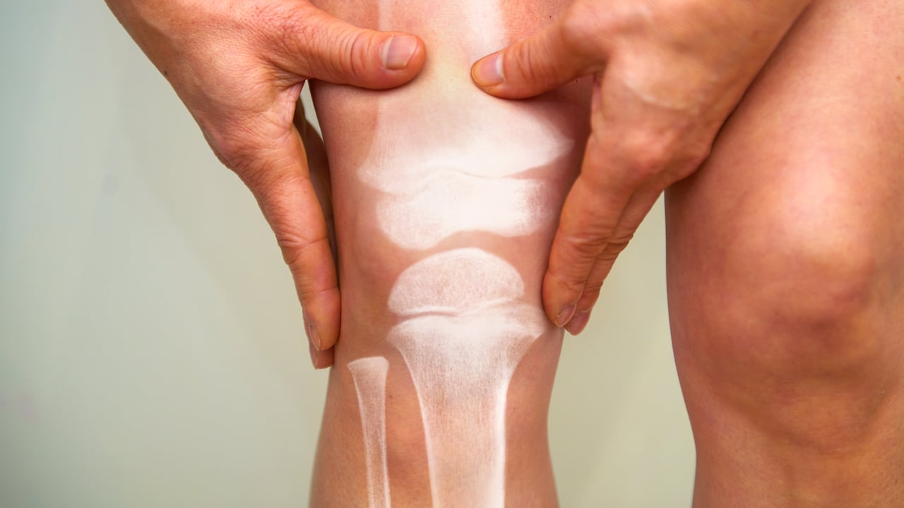 Huesos / Huesos mujer / Calcio