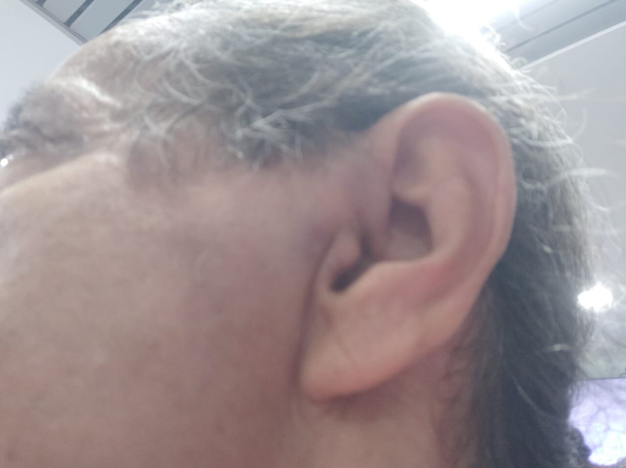 El golpe fue en el maxilar derecho, cerca al oído.