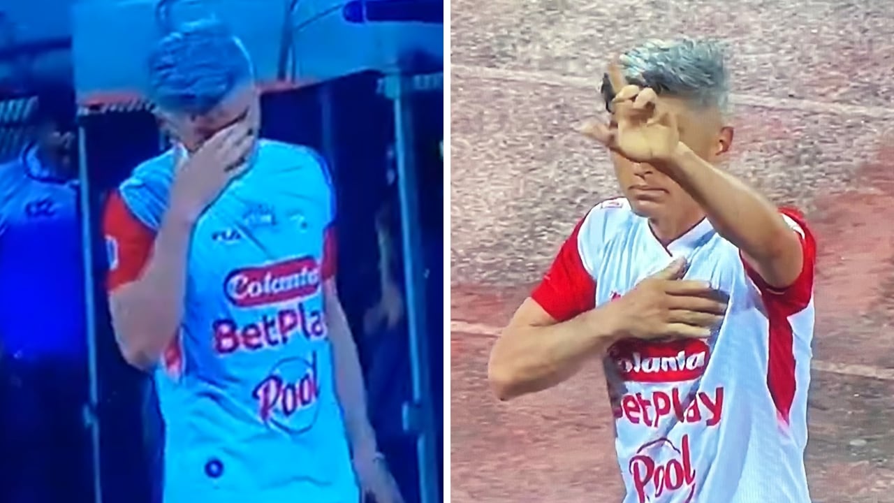 Daniel Torres resultó agredido en el juego de Independiente Medellín contra Santa Fe.