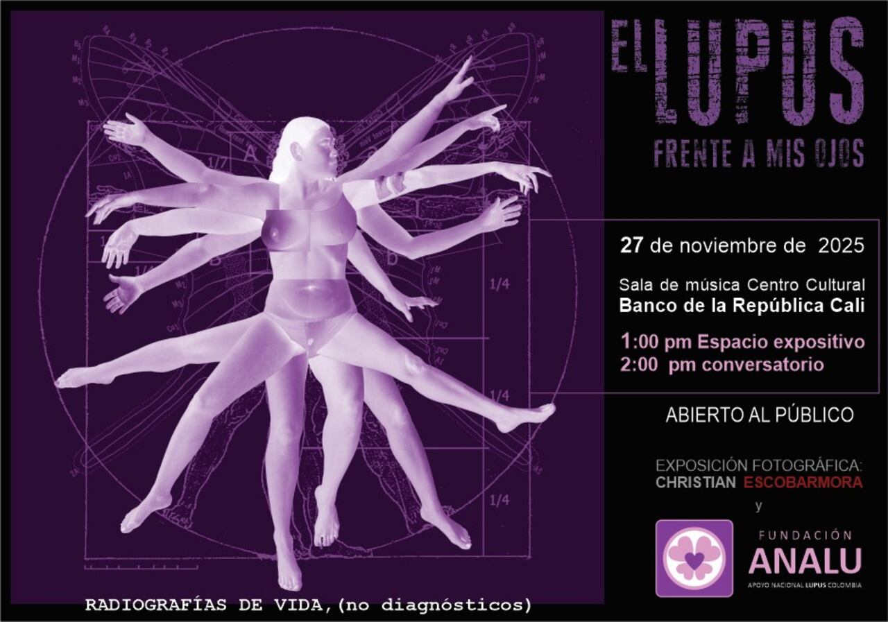 El arte revela lo que es vivir con lupus.