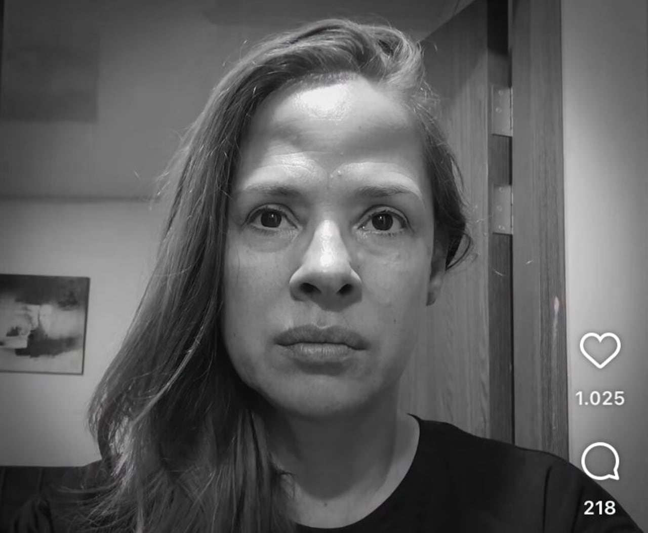 Mónica Hernández habló sobre cómo le afectó su salud una alergía.